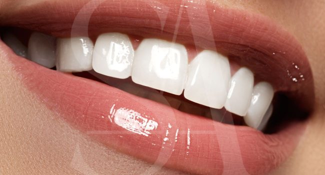 diseño-de-sonrisas-barcelona-carillas-dentales diseño-de-sonrisas-barcelona-carillas-dentales