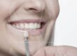 mock-up-dental-estetica-barcelona