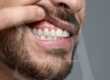 periodontitis-solucion-carillas-dentales